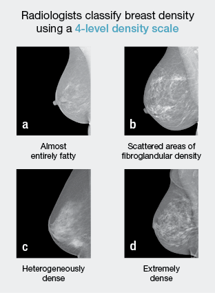 breast_density_scale_portrait1